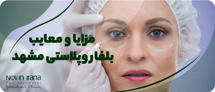 مزایا و معایب بلفاروپلاستی مشهد